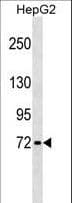 GBP4 / Mpa2 Antibody (aa370-396)