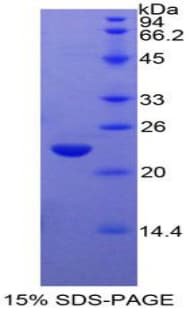 Rat GAA / Alpha-Glucosidase, Acid Protein (Recombinant His-T7)