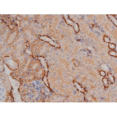 SYN / FYN Antibody (phospho-Tyr530)