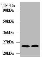 Polyclonal Rabbit anti-Human HMG-CoA Reductase / HMGCR Antibody (IHC, WB)