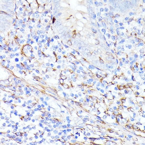 CCDC6 Antibody