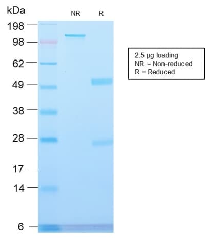 MVP / VAULT1 Antibody (clone VP2897R)