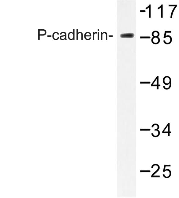 CDH3 / P-Cadherin Antibody (Gly78)