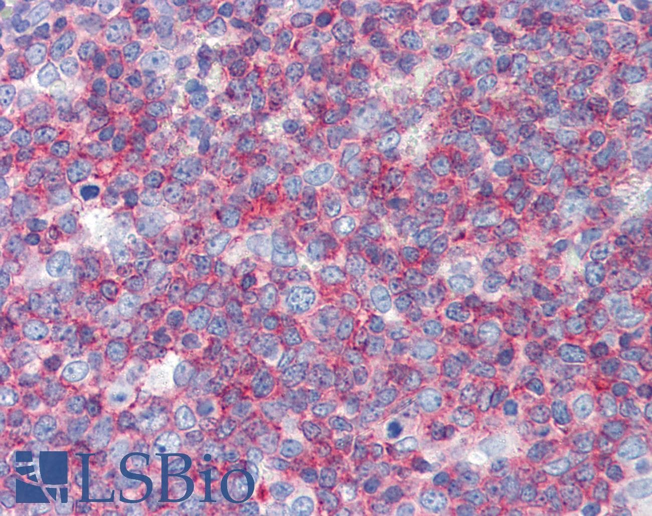 IHC-plus™ Monoclonal Mouse anti-Human CD45 / LCA Antibody (clone 3G4, aa1029-1249, IHC, WB)