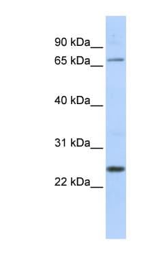 ZNF835 Antibody (aa306-355)