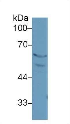 PPARG / PPAR Gamma Antibody (aa311-493)