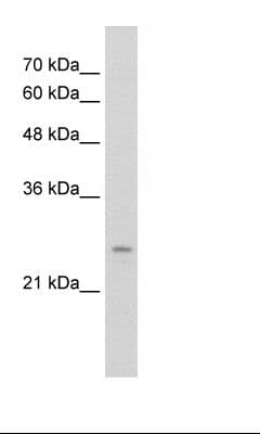 IER2 Antibody (aa46-95, FITC)