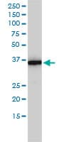MTHFD2 Antibody (clone 4G7-2G3)