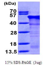 Human RCN1 / Reticulocalbin 1 Protein (Recombinant His)