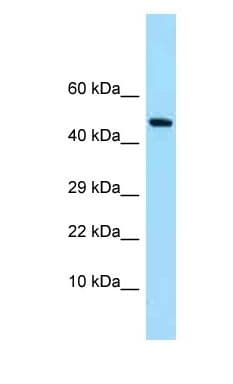 SYNC / SYNCOILIN Antibody (aa92-141)