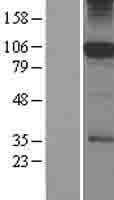 SFMBT1 Protein (Over-Expression Lysate Myc-DDK (Flag))