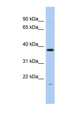 RWDD2A Antibody (aa35-84)