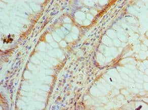 MUTYH / MYH Antibody (aa1-265)