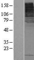 SLC5A8 / AIT Protein (Over-Expression Lysate Myc-DDK (Flag))