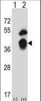 TFIIB Antibody (aa42-71)