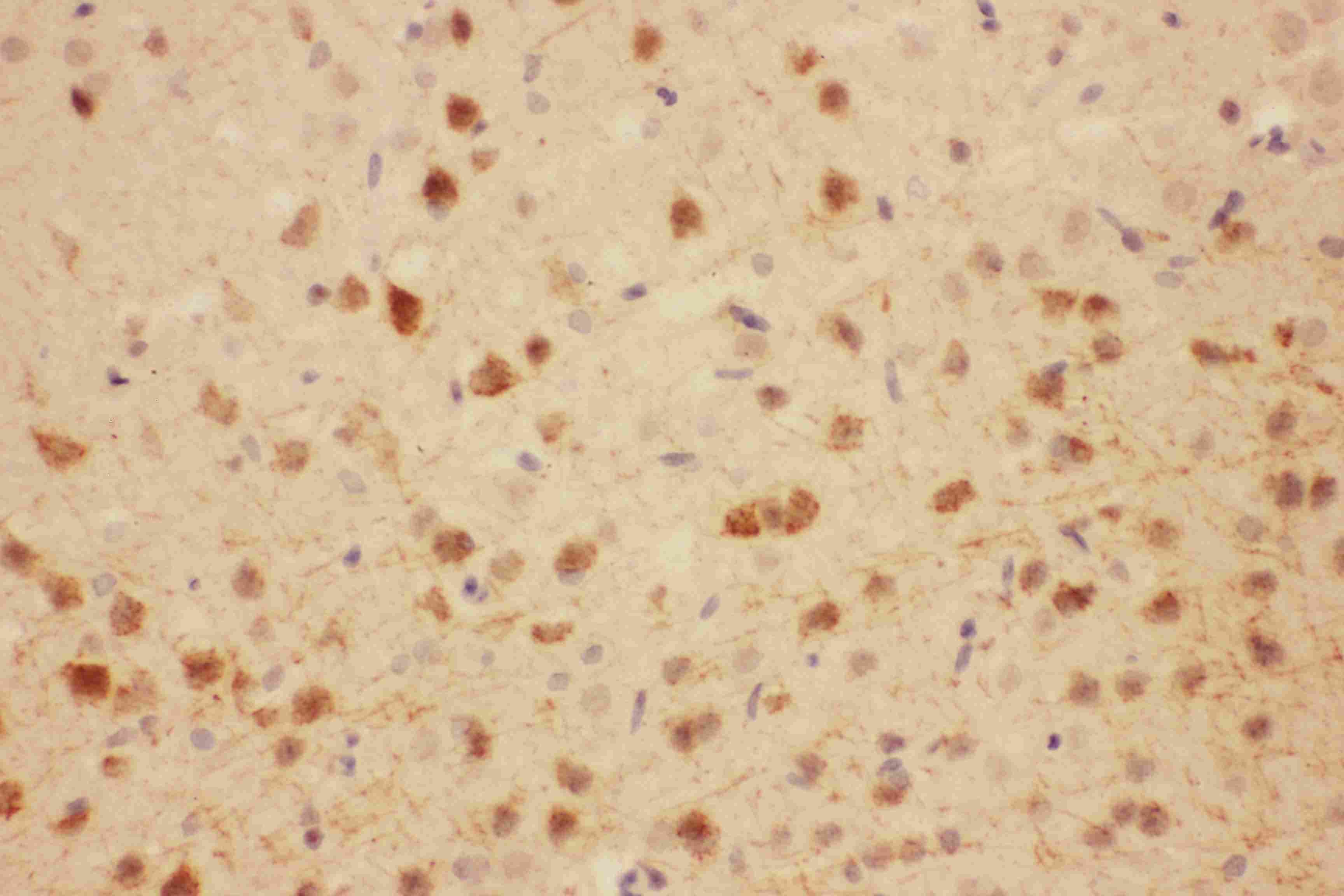 Polyclonal Rabbit anti-Human MAG Antibody (aa114-132, IHC, WB)