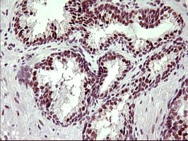 UPRT Antibody (clone OTI2D10)