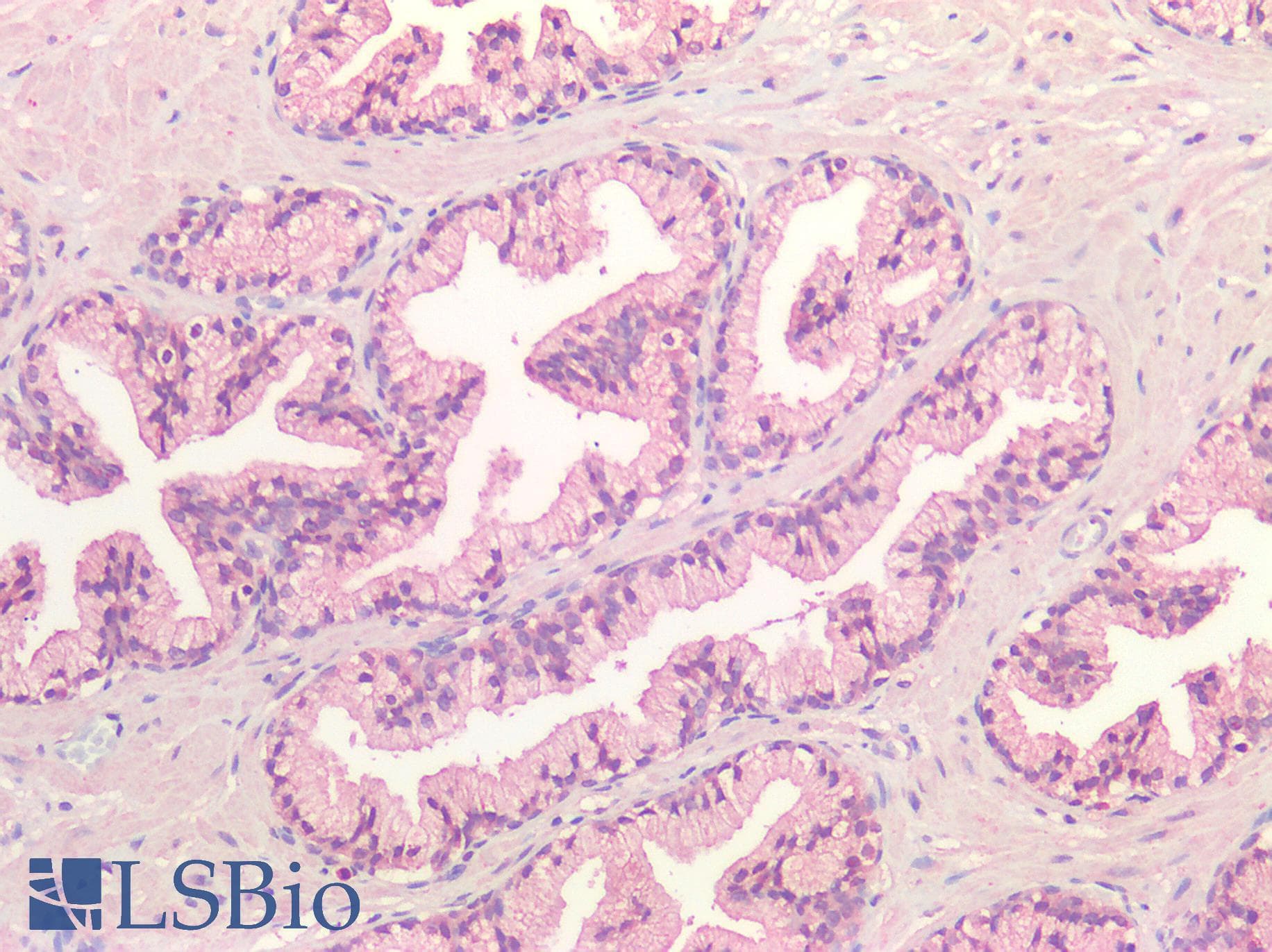 IHC-plus™ FZD7 / Frizzled 7 Antibody (N-Terminus)