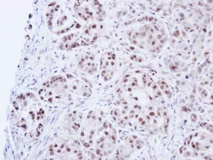 Polyclonal Rabbit anti-Human LIG3 / DNA Ligase III Antibody (aa116-433, IHC, WB)