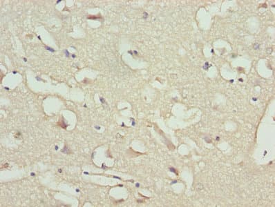 NPPB / BNP Antibody (aa27-101)