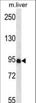 Polyclonal Rabbit anti-Human PDZD4 Antibody (aa113-141, WB)