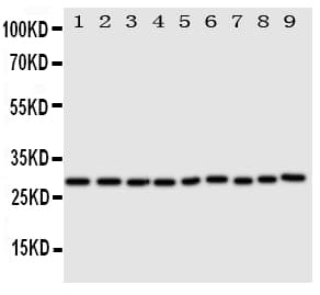 PRDX3 / Peroxiredoxin 3 Antibody (aa240-257)