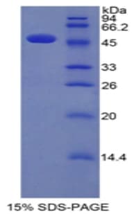 Human IFNA / Interferon Alpha Protein (Recombinant His-GST)