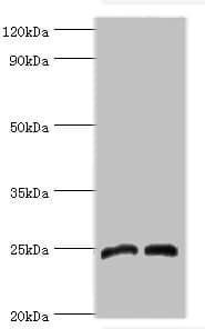 DKK4 Antibody (aa19-224)