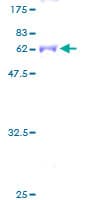 Human CRYM Protein (Recombinant GST)