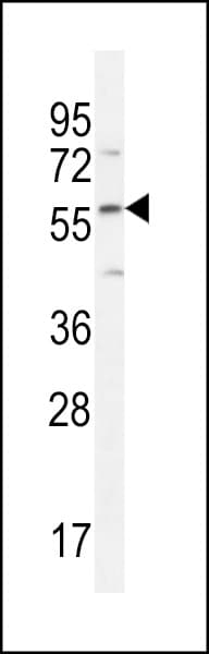 IHC-plus™ FAM20C Antibody (aa443-471)