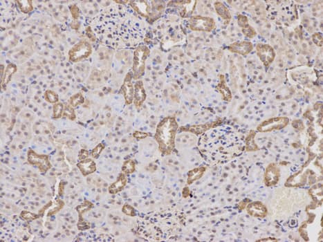 PTPN2 / TC-PTP Antibody