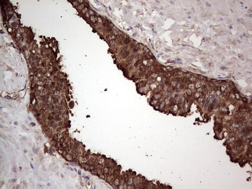 PKM2 Antibody (clone 12B9)
