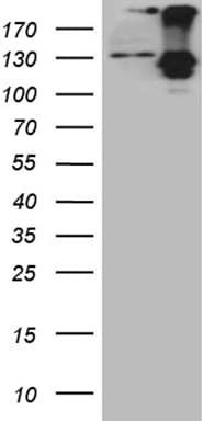 ROR2 Antibody (aa796-927, clone OTI2G1)