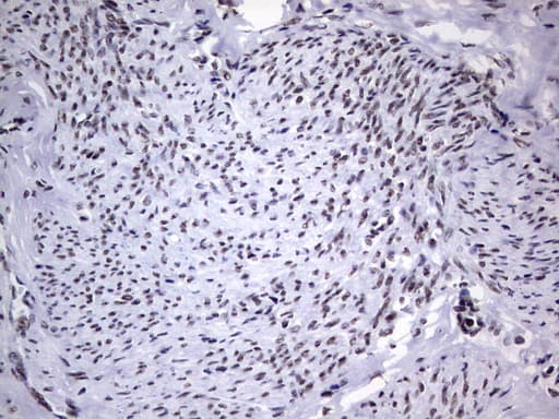 Monoclonal Mouse anti-Human PPP1R8 / Rnase E Antibody (clone OTI4E5, aa1-225, IHC, WB)