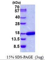 Human CDK2AP2 Protein (Recombinant His)