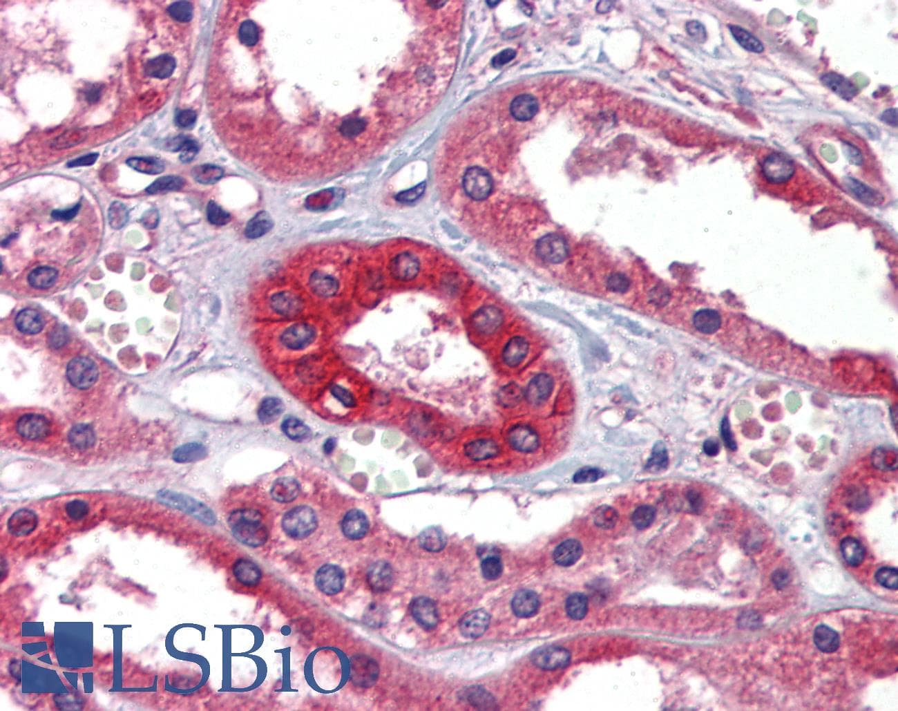 Polyclonal Rabbit anti-Human FOLR1 / Folate Receptor Alpha Antibody (FITC, aa179-228, IHC, WB)