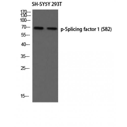 SF1 Antibody (20-100 aa)