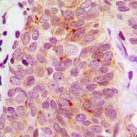 RPS6KB1 / P70S6K / S6K Antibody (C-Terminus)
