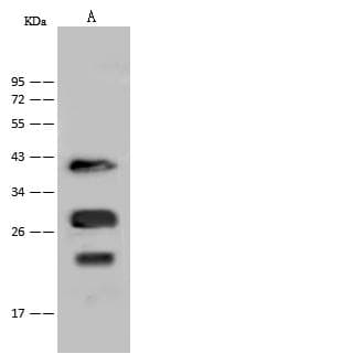 NKX3-1 Antibody (Preservative Free)