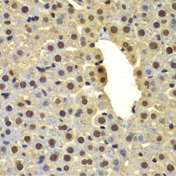 Polyclonal Rabbit anti-Human DTX2 Antibody (IHC, WB)