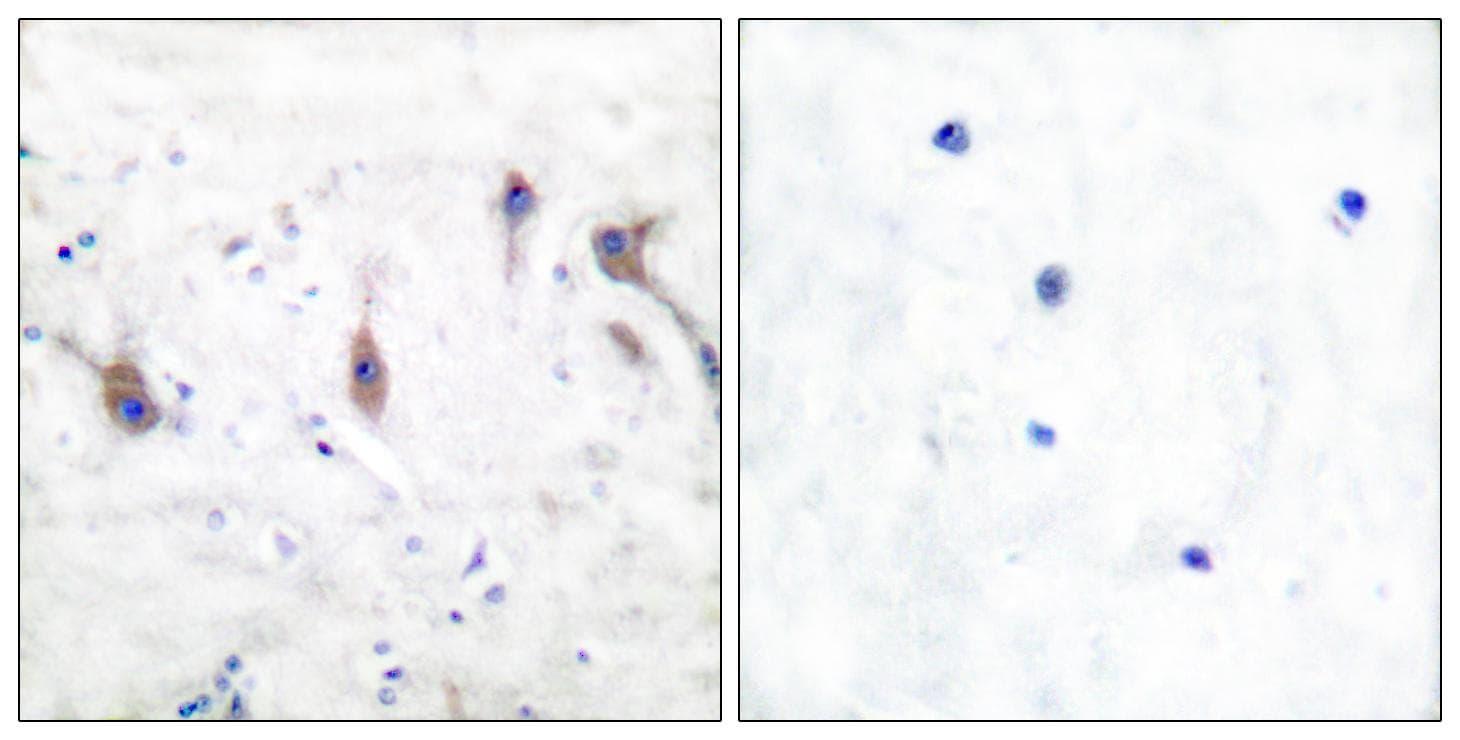 ARC / Arg3.1 Antibody