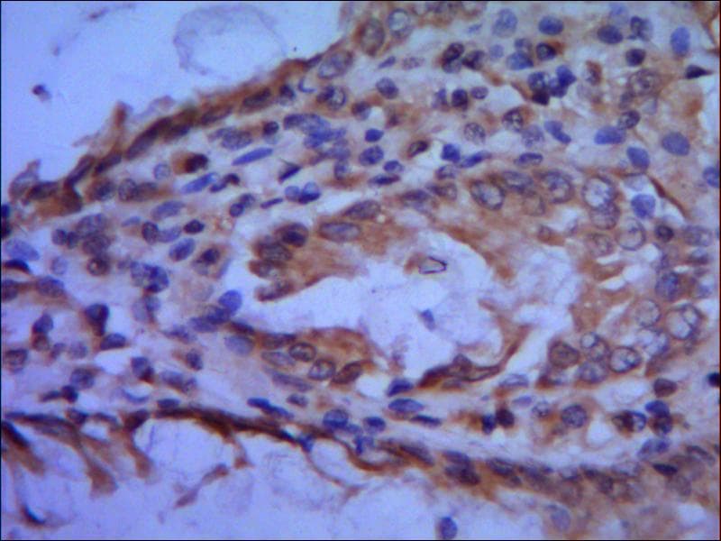 TFIIB Antibody