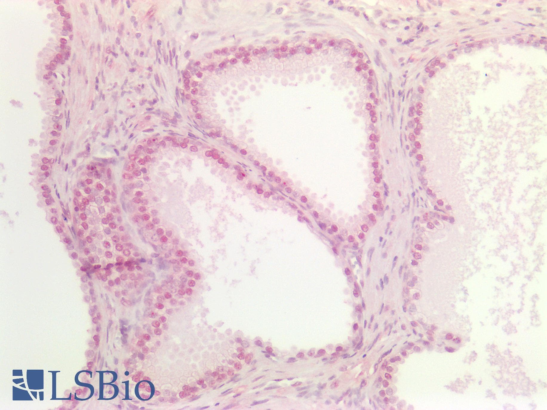 PathPlus™ DNMT / DNMT1 Antibody (aa637-650, clone 60B1220.1)