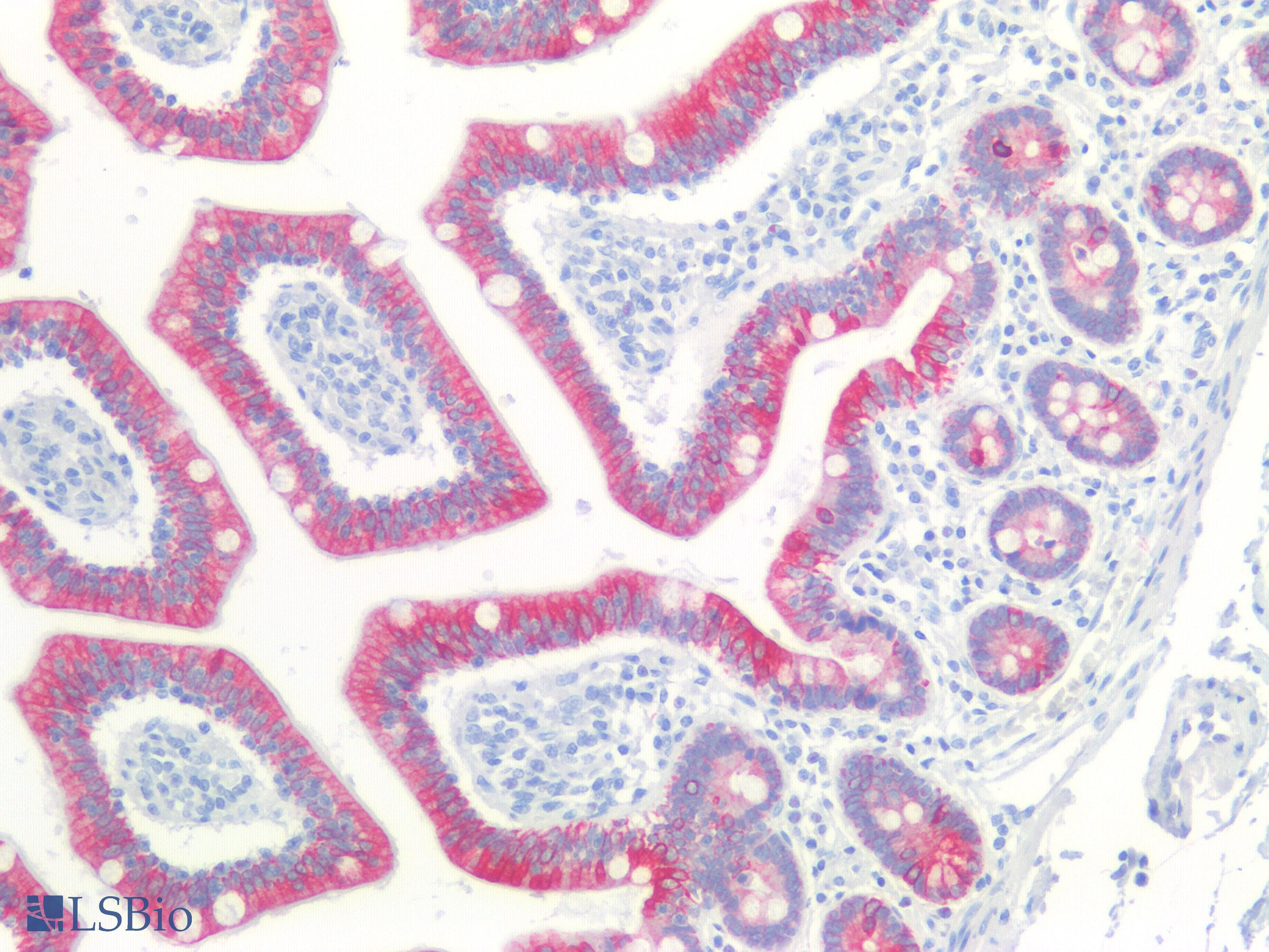 PathPlus™ KRT18 / CK18 / Cytokeratin 18 Antibody