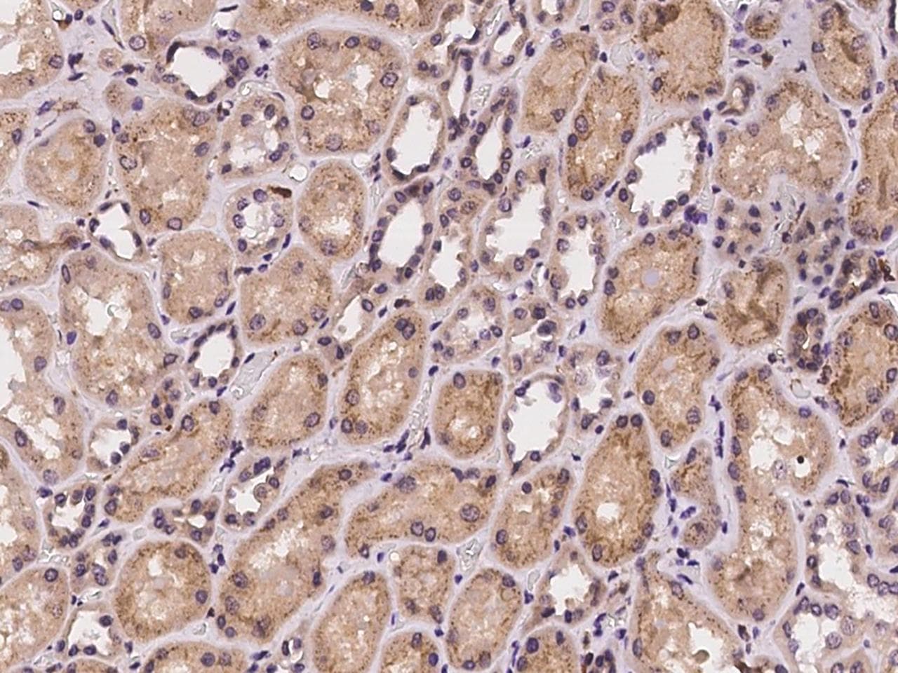 CHST10 Antibody
