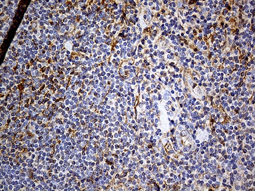 PDPN / Podoplanin Antibody (aa23-131, clone OTI7B4)