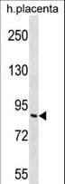 ADGRF2 / GPR111 Antibody (aa366-393)