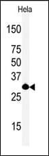ASCL1 / MASH1 Antibody (Asp220, C-Terminal)
