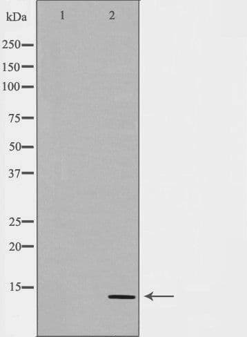 CGA / hCG Alpha Antibody