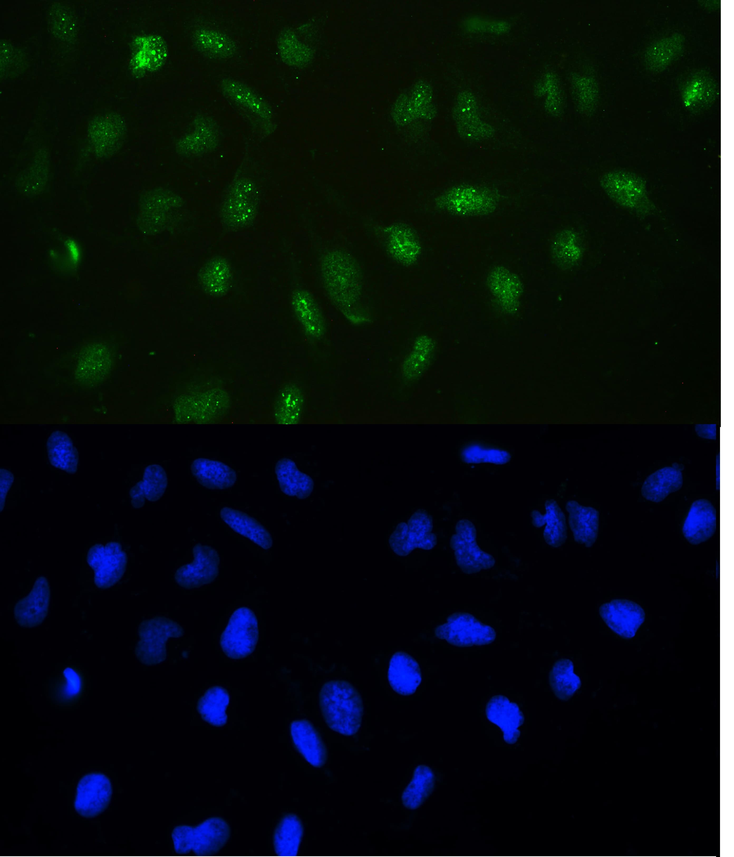 DNMT / DNMT1 Antibody
